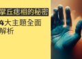 掌丘痣相的秘密：4大主題全面解析